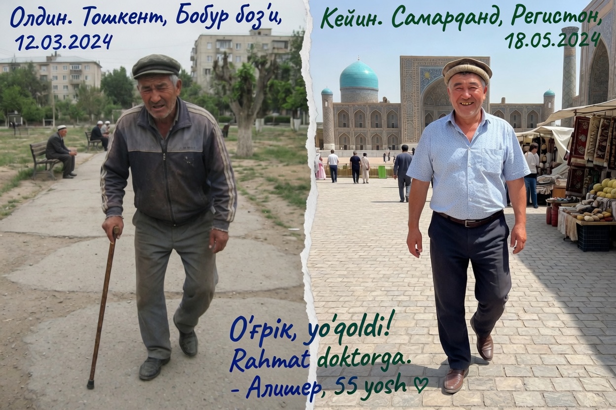До и после: колени